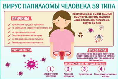 ВПЧ 59 типа