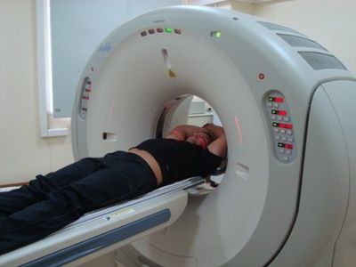МРТ сосудов головного мозга