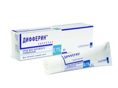 Дифферин