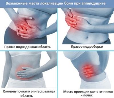 Локализация боли