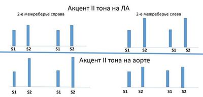Акценты тонов сердца