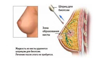 Проведение процедуры