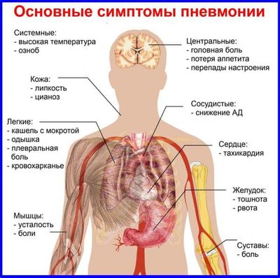 osnovnye-simptomy-pnevmonii