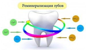 Реминерализация зуба