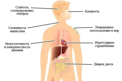 признаки гипотонии