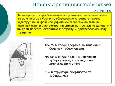 Характеристика заболевания