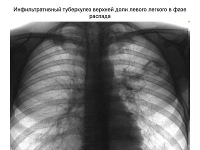 Фаза распада