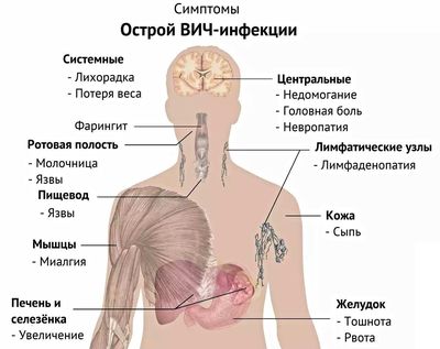 Симптомы ВИЧ