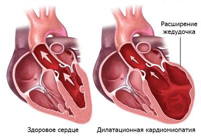 Дилатационная форма
