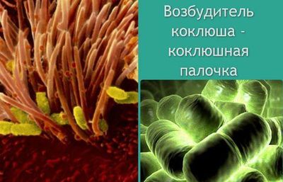 Возбудитель коклюша
