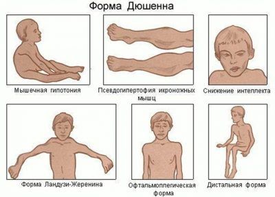 Иллюстрация 2