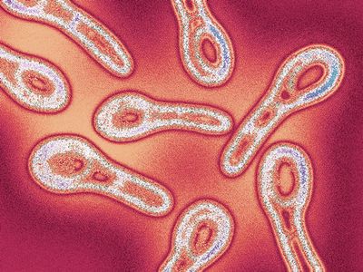 Дифтерийная палочка (Corynebacterium)