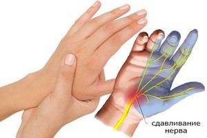 Почему немеют руки во время сна