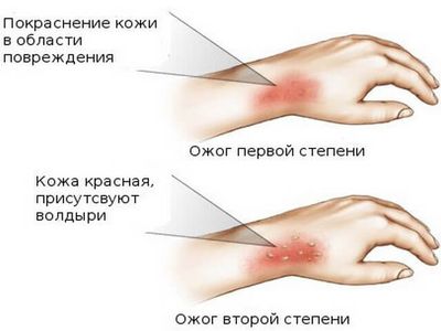 Симптомы возникновения травмы