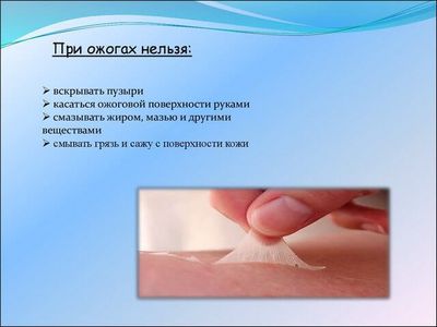 Как нельзя лечить ожоги