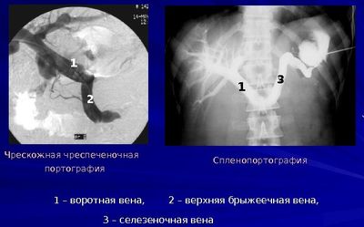 Портография