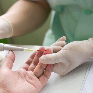 Норма лейкоцитов в крови варьируется в зависимости от возраста и пола человека