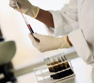 WBC (лейкоциты): диагностика и расшифровка анализа крови