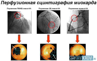 Показания