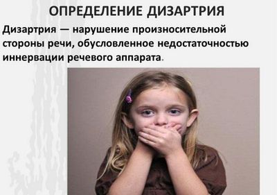 Дизартрия
