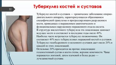 Поражение суставов и костей