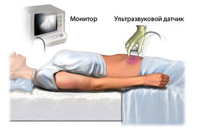 Трансабдоминальное обследование